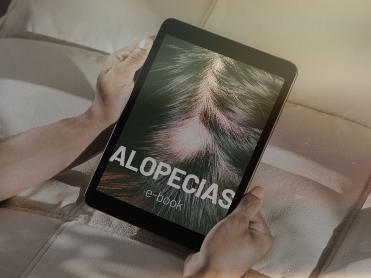 E-book sobre alopecia